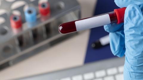 Labordiagnosztikai szolgáltatót váltott a Budaörsi Egészségügyi Központ